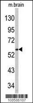 PACSIN1 Antibody (N-term)