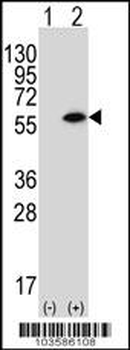 PACSIN1 Antibody (N-term)