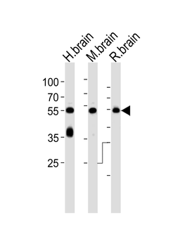 PACSIN1 Antibody (N-term)