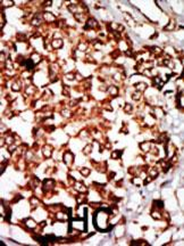 NRBP Antibody (N-term)