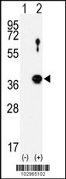 NEK6 Antibody (N-term)