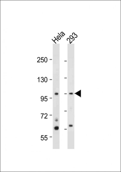 NEK4 Antibody (C-term)