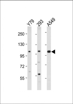 NEK4 Antibody (C-term)