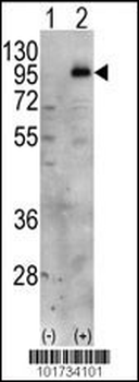 PIP5KI gamma (PIP5K1G) Antibody (C-term)