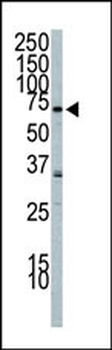 PI3KR2 Antibody (C-term)
