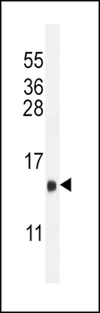 LHB Antibody (C-term)