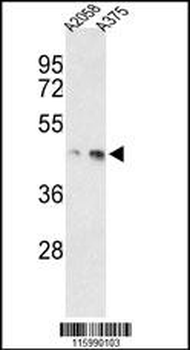 MEK1 Antibody (S218/222)