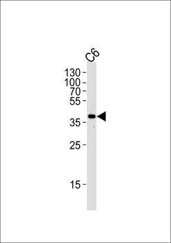 MEK1 Antibody (S218/222)