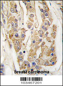 COT (MAP3K8/MEKK8) Antibody (C-term)