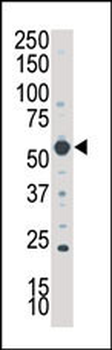 SGK3 Antibody (N-term)