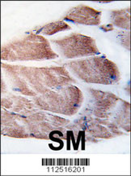 RSK2 (RPS6KA3) Antibody (N-term)