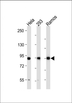 RSK2 (RPS6KA3) Antibody (N-term)