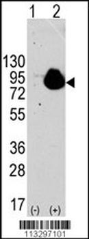 RPS6KA1 Antibody (S732)