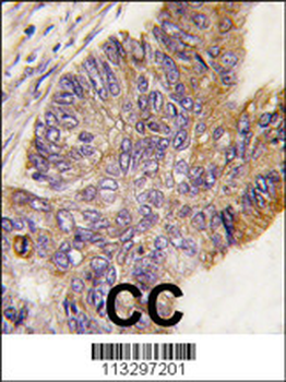 RPS6KA1 Antibody (S732)