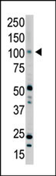 PRK2 Antibody (C-term)