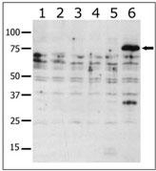 PAK6 Antibody
