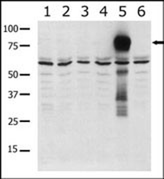 PAK5 Antibody