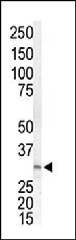 MEK3 (MAP2K3) Antibody (N-term)