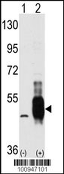 COT (MAP3K8/MEKK8) Antibody (C-term)