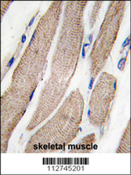 MAP2K5 Antibody (S149)