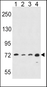 ALOX15 Antibody (C-term)