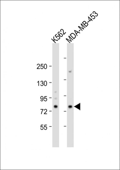 ALOX15 Antibody (C-term)