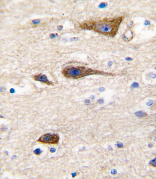 CYP2R1 Antibody (Center)