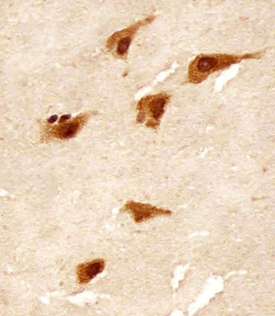 TBK1 Antibody (S172)