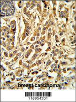 CYP21A2 Antibody (Center)