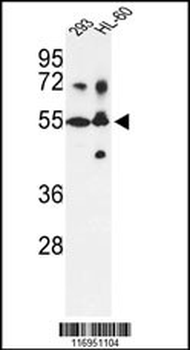 CYP21A2 Antibody (N-term)