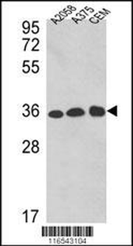 GAPDH Antibody (C-term R248)