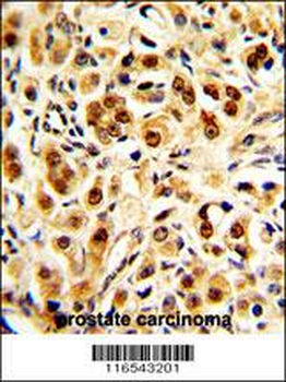 GAPDH Antibody (C-term R248)