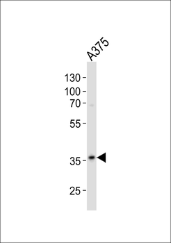 GAPDH Antibody (N-term)