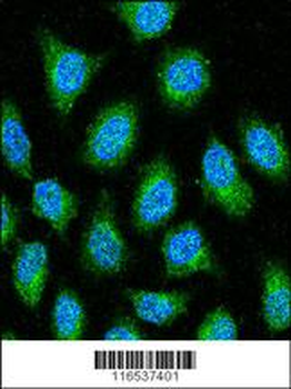 GAPDH Antibody (N-term)