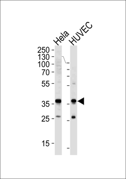 GAPDH Antibody (N-term)