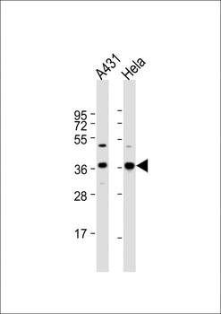 GAPDH Antibody (N-term)