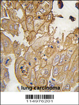 GMFG Antibody (N-term)