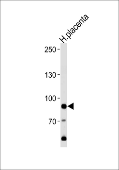 AMPD3 Antibody (Center)