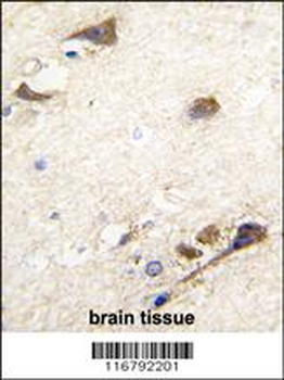 ACHE Antibody (N-term)