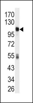 ALDH1L1 Antibody (C-term)