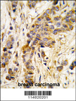 IARS2 Antibody (Center)