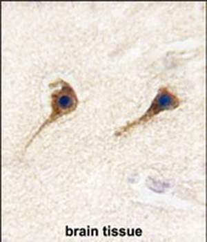 SARS2 Antibody (N-term)