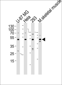 SARS2 Antibody (N-term)