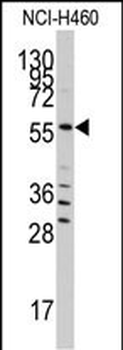 SARS Antibody (C-term)