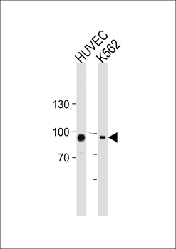 Transglutaminase (TGM2) Antibody (Center K444)