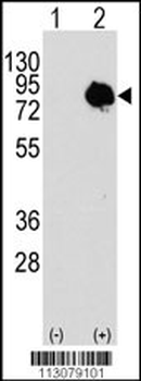 Transglutaminase (TGM2) Antibody (Center T428)