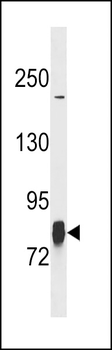 LIM Kinase 1 (LIMK1) Antibody (N-term)