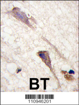 B-RAF Antibody (S601)