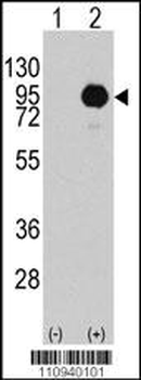 B-RAF Antibody (S445)