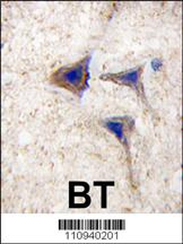 B-RAF Antibody (S445)